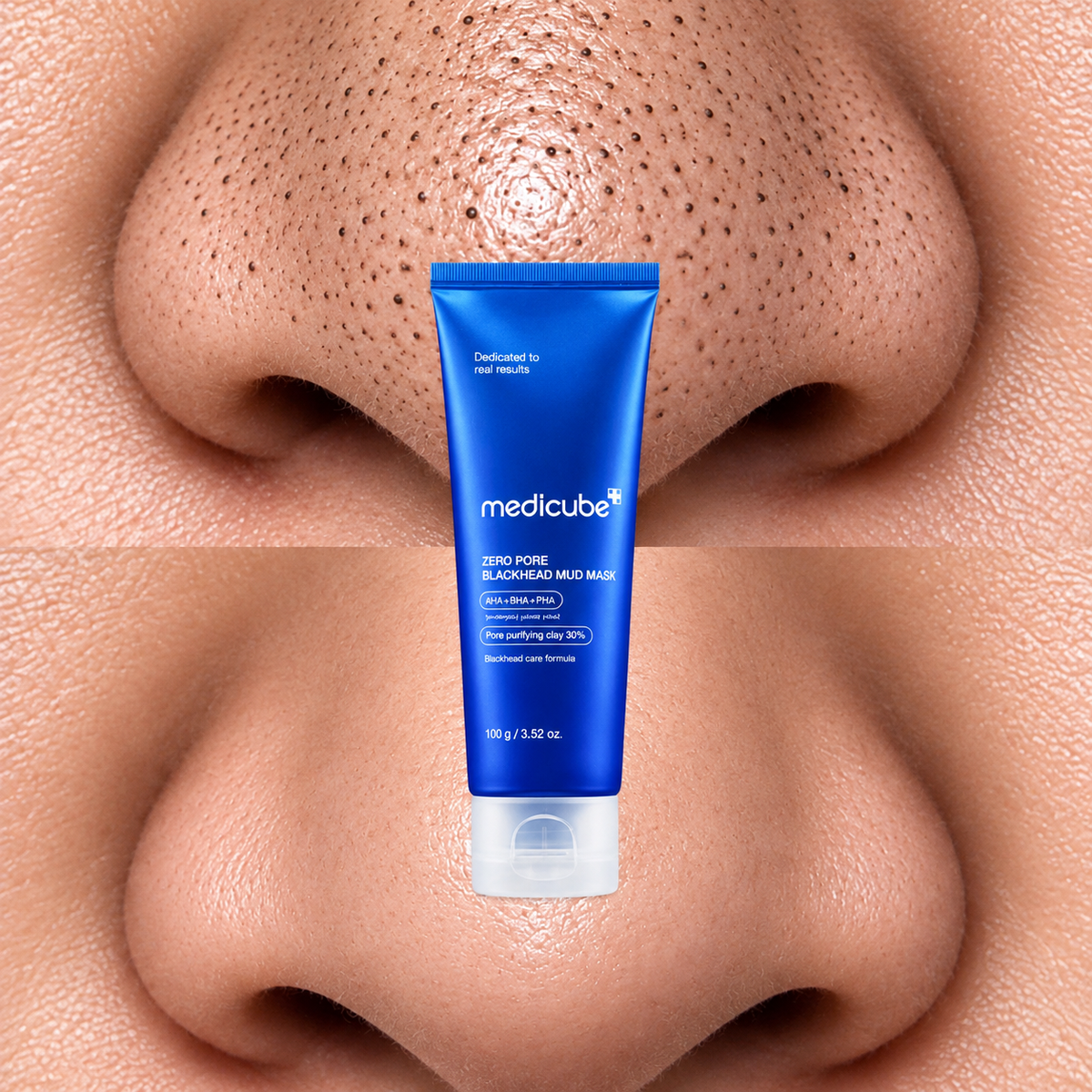 Medicube Zero Pore Blackhead Mud Mask 100g